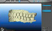 Invisalign in Greenwich