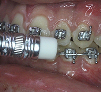 Children s Orthodontist in Greenwich